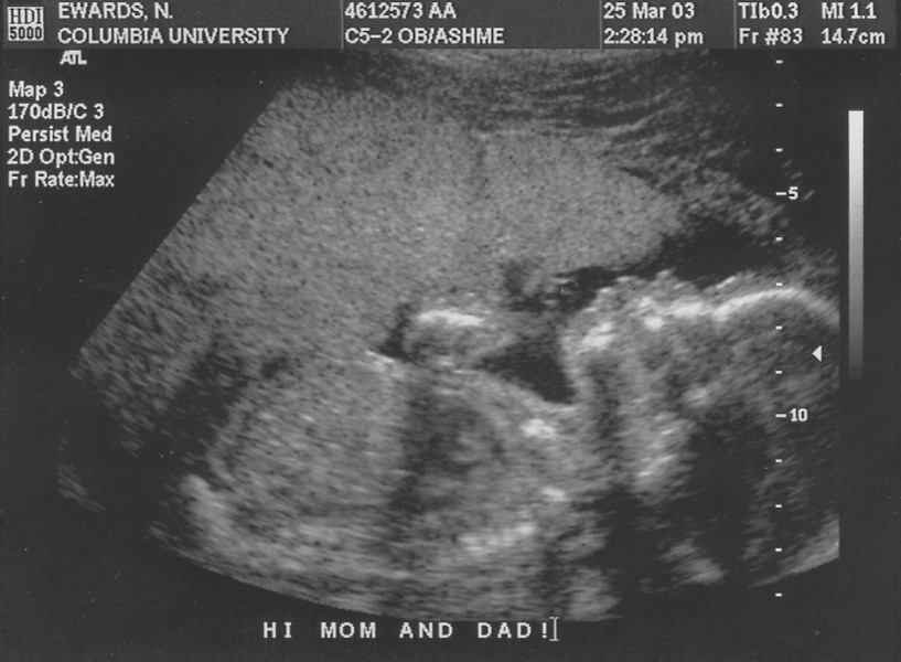 p3250001 Kyle Ultrasound