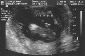 p2030001 Its A Boy Ultrasound