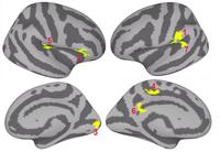 Overlapping Semantic Representations of Sign and Speech in Novice Sign Language Learners